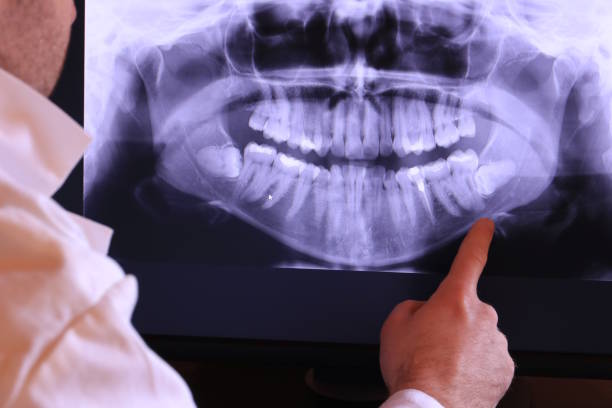 Tooth Infection Emergency Dentist in VA