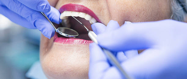 Best Chipped Tooth Repair Near Me  in Cedar Bluff, VA